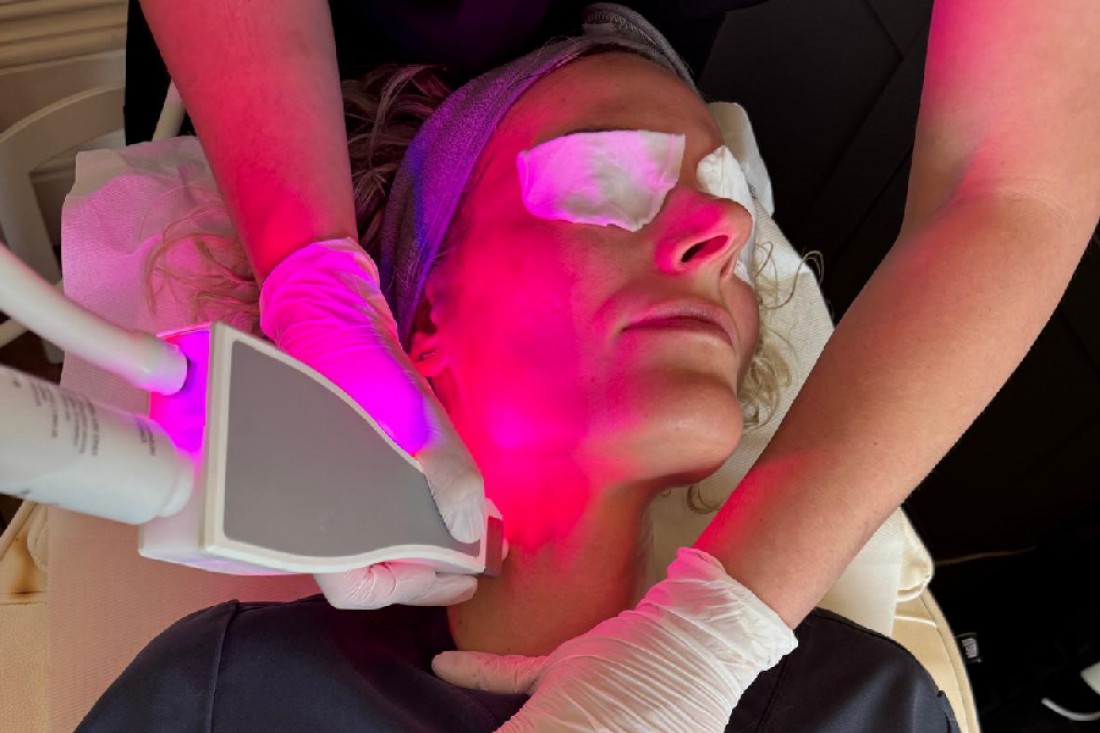 Dr Kasia performing SKINSTORM treatment